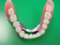 当院の義歯治療について